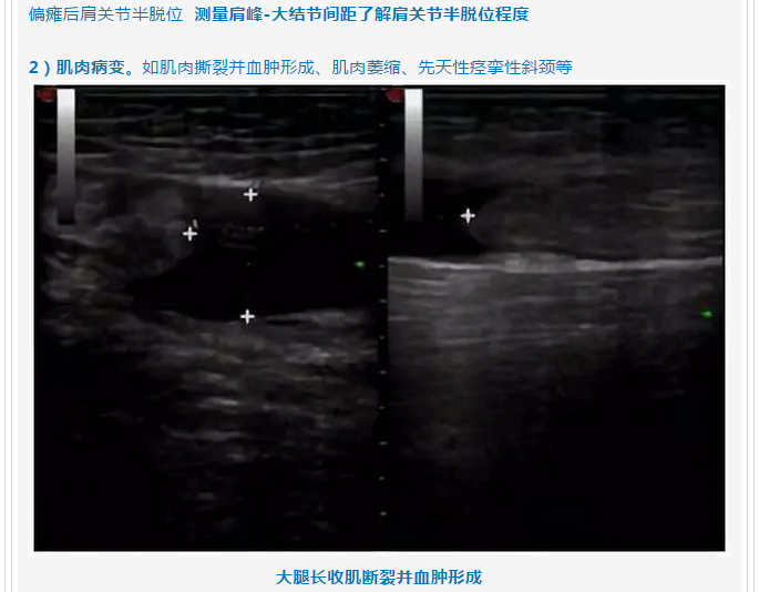 微信截图_20180814232836.png