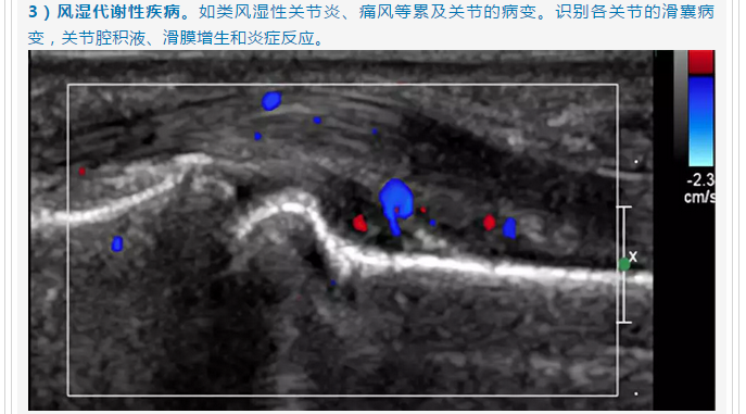 微信截图_20180814232905.png